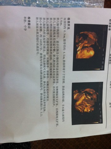 journal_insert_pic_147204965