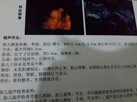 journal_insert_pic_147272888