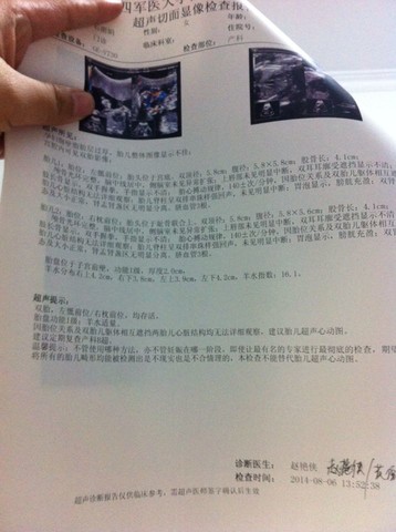 journal_insert_pic_148219990