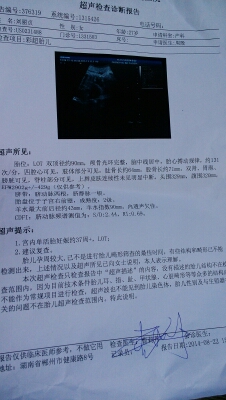 journal_insert_pic_151180590