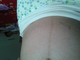 journal_insert_pic_151201631