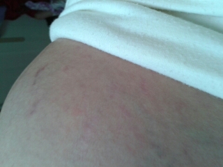 journal_insert_pic_151201608