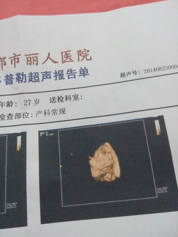 journal_insert_pic_151191916
