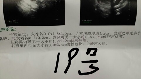 journal_insert_pic_151544164
