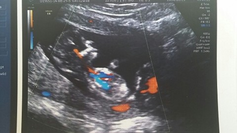 journal_insert_pic_151658929