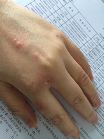 journal_insert_pic_152706021