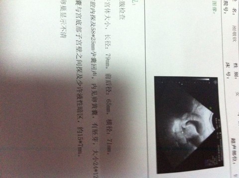 journal_insert_pic_154502335