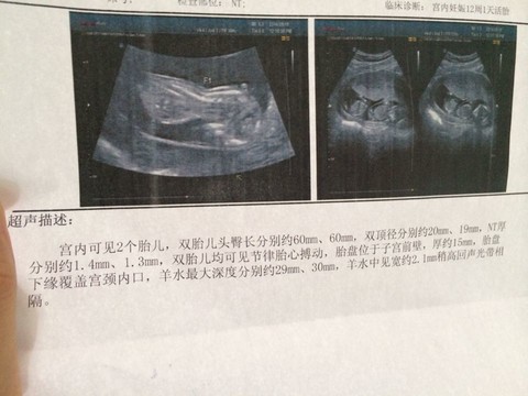 journal_insert_pic_154924448