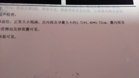 journal_insert_pic_155081410