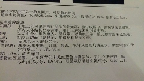 journal_insert_pic_155547723