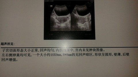 journal_insert_pic_155814847