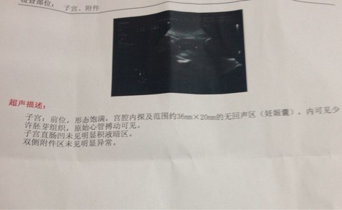 journal_insert_pic_156351063