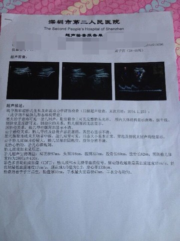 journal_insert_pic_158473583