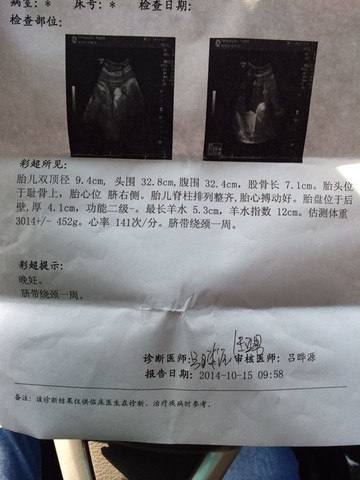 journal_insert_pic_159324870