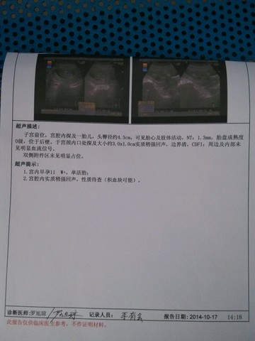 journal_insert_pic_159740305