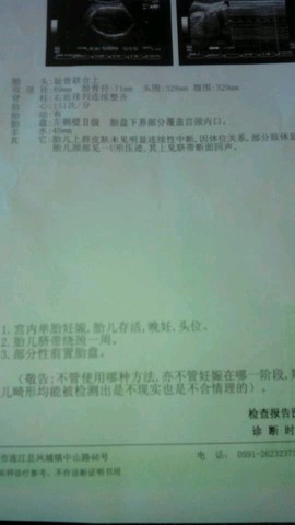 journal_insert_pic_159809431
