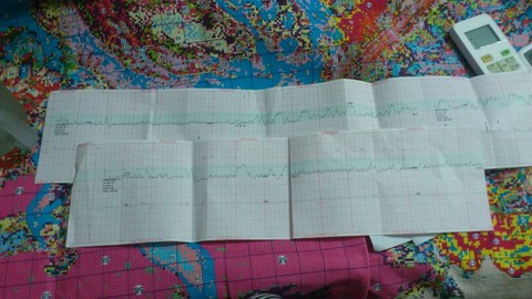 journal_insert_pic_160638094