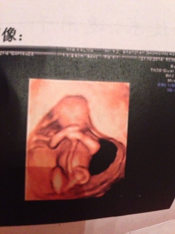 journal_insert_pic_162514216