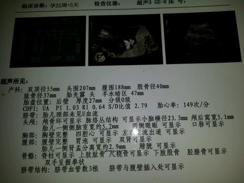 journal_insert_pic_165078630