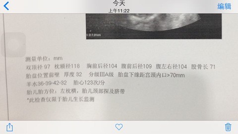 journal_insert_pic_166774791