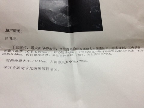 journal_insert_pic_166847891