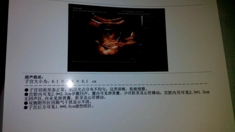 journal_insert_pic_167227951