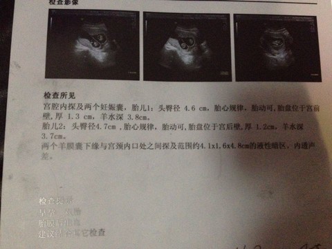 journal_insert_pic_167599870