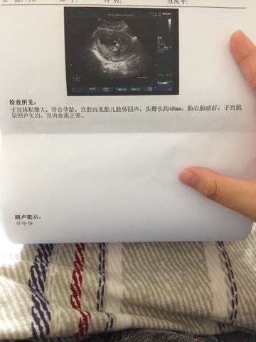 journal_insert_pic_168126512