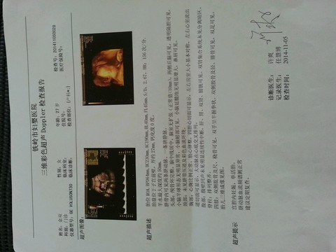 journal_insert_pic_167994309