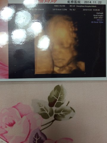 journal_insert_pic_168895217