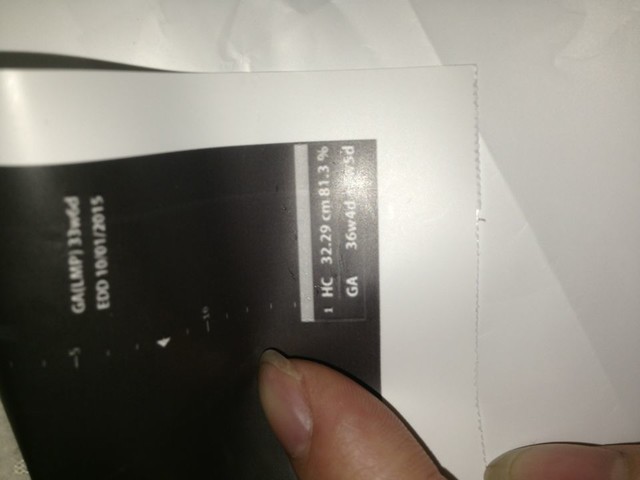 孕34周,胎儿偏大2周5天,已经6斤了