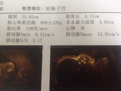 journal_insert_pic_171083045