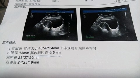 journal_insert_pic_172145927