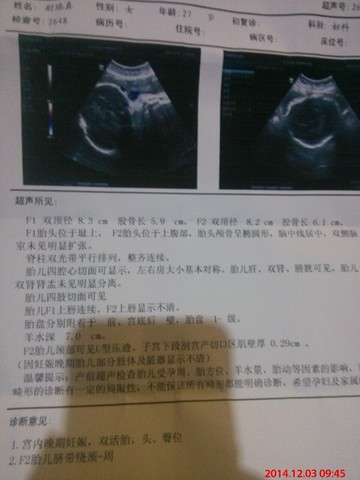 journal_insert_pic_172101491
