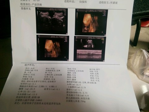 journal_insert_pic_172005447