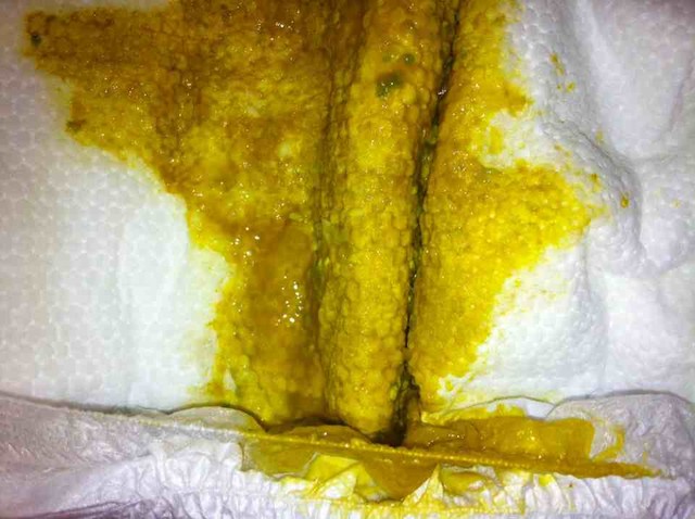 宝宝拉肚子怎么办