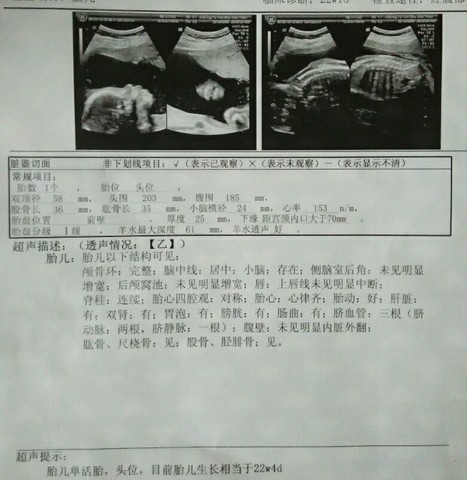 journal_insert_pic_172770987