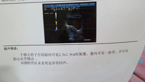 journal_insert_pic_173157036