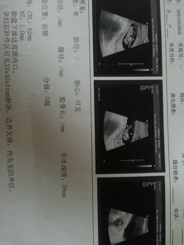 journal_insert_pic_177295923