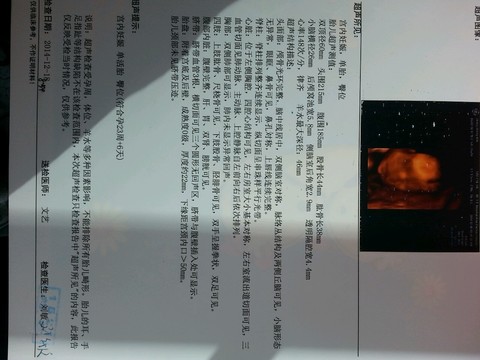 journal_insert_pic_177809331