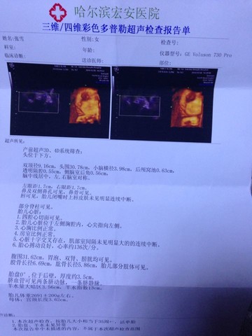 journal_insert_pic_179029884