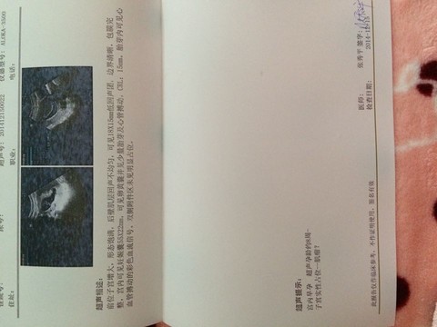 journal_insert_pic_185907362