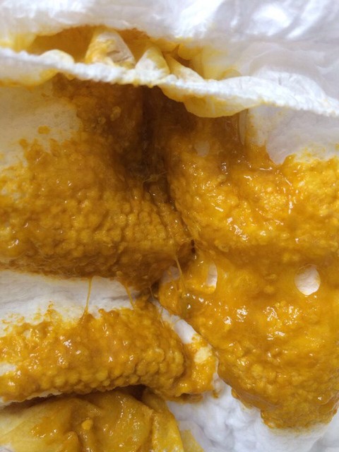 宝宝大便鼻涕状有图