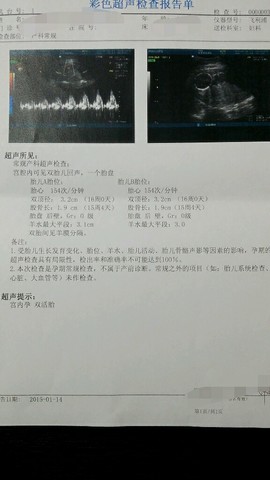 journal_insert_pic_190212708