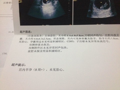 journal_insert_pic_190744182
