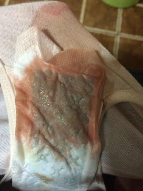 有宝妈知道吗?有图慎入!