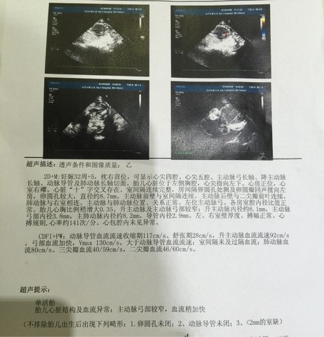 journal_insert_pic_205210762