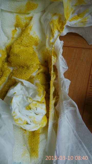 第一次吃香蕉 这是不消化?过敏是什么表现啊?