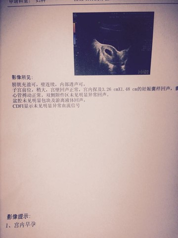 journal_insert_pic_208855271