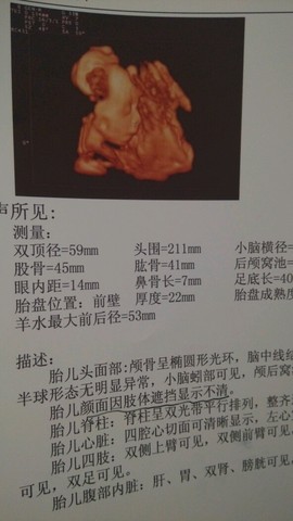 journal_insert_pic_210751772